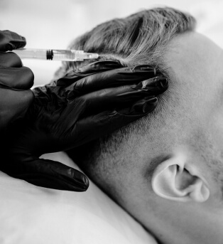 Hair Restoration in Libertyville