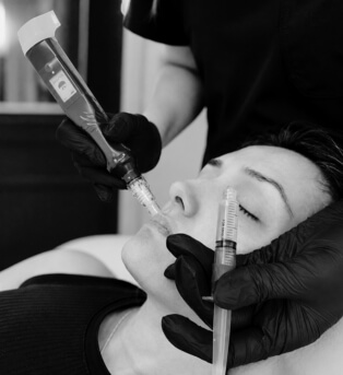 Microneedling & PRP Facial Libertyville